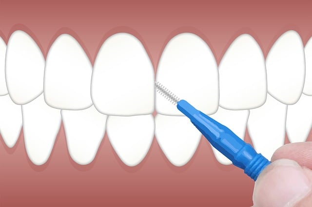 Brossette interdentaire — Que choisir entre le fil dentaire et les brossettes ?