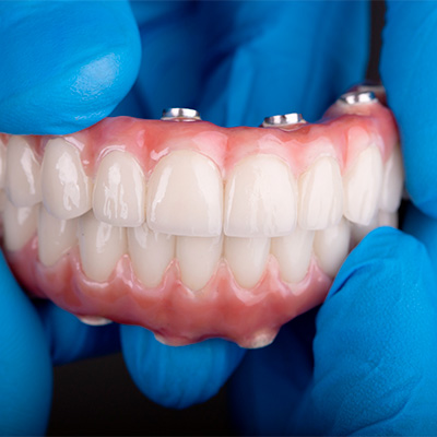 Confort — Comment améliorer le confort de votre prothèse dentaire - Dr.DIENER