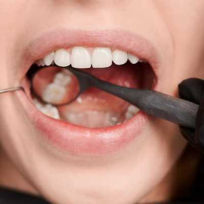 Dentier — Comment améliorer le confort de votre prothèse dentaire - Dr.DIENER