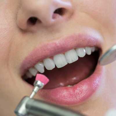 Examendent — Comment garder mes dents blanches ?