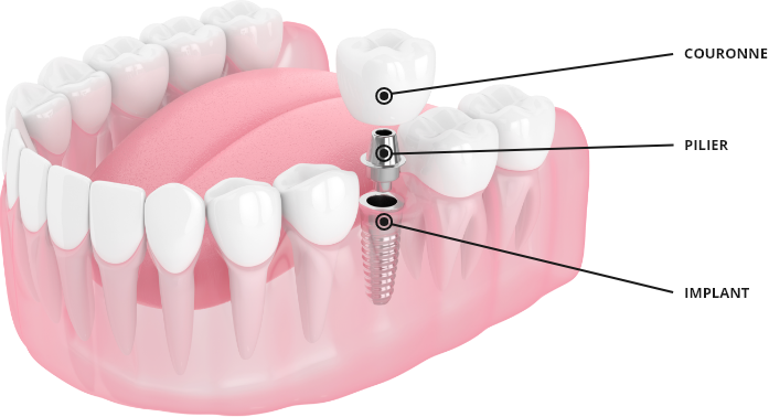 Highlight — Cabinet dentaire & dentistes à Saint-Louis