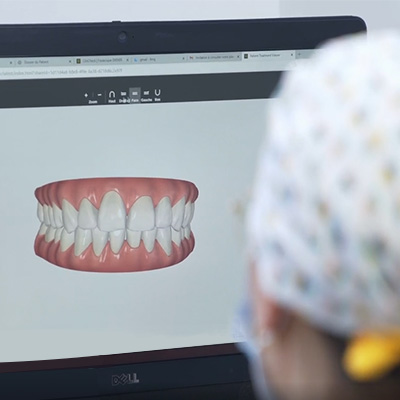 Orthodontie — L'orthodontie invisible