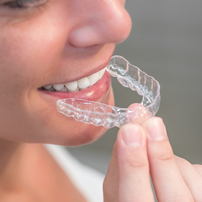 Orthodontie — L'orthodontie invisible
