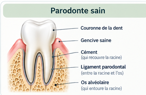 Schéma d'un parodonte sain : couronne de la dent, gencive saine, cément, ligament parodontal et os alvéolaire