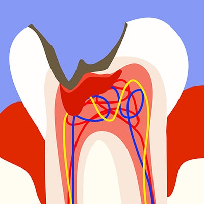 Soins — Les soins conservateurs