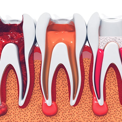 Soins — Les soins conservateurs